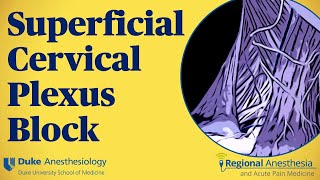 Superficial cervical plexus block [upl. by Sulienroc]