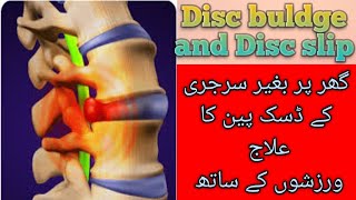 Backpain treatment by dr warda  S6  Exercises for disc pain  UrduHindi [upl. by Seligmann]