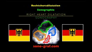 Echokardiographie  Rechtsherzdilatation [upl. by Nahtanoy111]