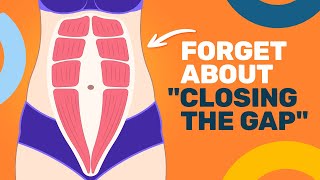 Why You DONT Need to Close Your Diastasis Recti Gap [upl. by Irved]