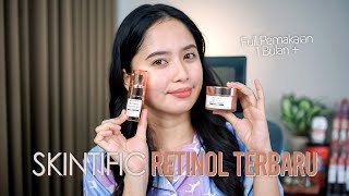 Review Retinol SKINTIFIC selama 1 BULAN   SKINTIFIC Retinol Skin Renewal [upl. by Etnud]