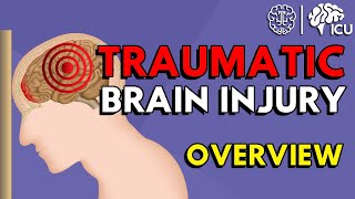 Overview of Traumatic Brain Injury TBI [upl. by Vogel193]