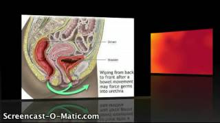 UTIs from Ecoli [upl. by Eanram]