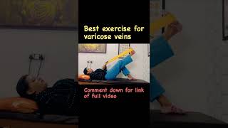 Varicose Veins Exercise 👍🏼 subscribe for full video  varicoseveins workoutathome viral [upl. by Leind]