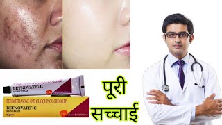 All About Betnovate Cream  Betnovate Cream Uses amp Side Effects  Dr Jangid  SkinQure  Delhi NCR [upl. by Tuddor735]