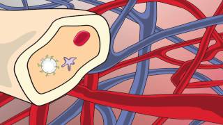 Video 2 Blood Stem Cell Video [upl. by Enyaht]