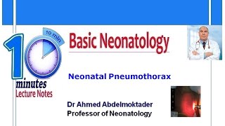 Neonatal Pneumothorax [upl. by Enak]