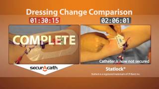 SecurAcath vs Statlock dressing change [upl. by Carmon]