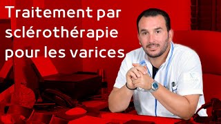 Traitement par sclérothérapie pour les varices [upl. by Abe]