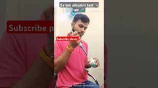 serum albumin test blood Test albuminalbumin bloodtest aj ki rattaiims initialscreening jart [upl. by Chui]