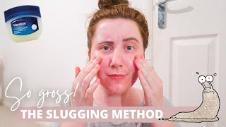 I Tried SLUGGING For A Week With ACNE Prone Skin [upl. by Moll]