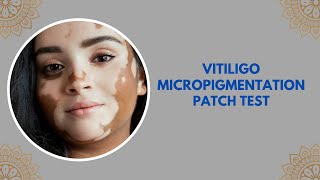 Vitiligo Micropigmentation patch test Contact RejuveDERMA Clinic [upl. by Alecram]