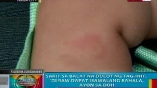 BP Sakit sa balat na dulot ng taginit di dapat isawalang bahala ayon sa DOH [upl. by Allisurd]