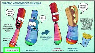 للأطباء chronic myeloid leukemia [upl. by Durrej]