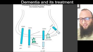 13 02  The amyloid cascade hypothesis of Alzheimer’s disease [upl. by Shererd66]