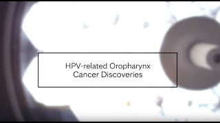 HPVrelated Oropharynx Cancer Discoveries  Mayo Clinic [upl. by Hamann]