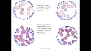 Malaria2 Plasmodium falciparum stages [upl. by Manaker]