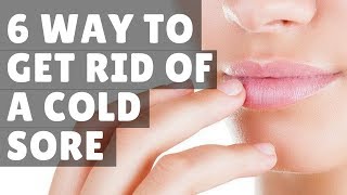 6 WAY to get rid of a cold sore home remedies fast overnight [upl. by Krm]