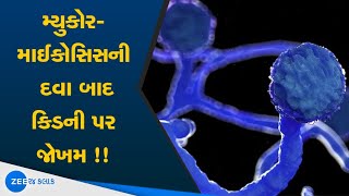 Mucormycosis ની દવા બાદ કિડની પર થતી અસરો Amphotericin injection Effects  દવાનો ઉપયોગ જોખમી [upl. by Ycnahc968]