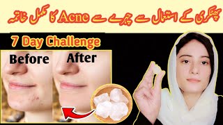 Alum for Acne  fitkari ka istemal  phitkari ka faidah  fitkari for skincare  Advocateifrah [upl. by Derreg]