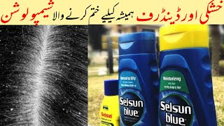 How to get rid of Dandruff Best Anti Dandruff Shampoo Selsun Blue Shampoo Review amp Price [upl. by Hesther761]