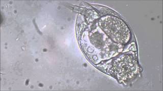 Rotifer Euchlanis [upl. by Asil]