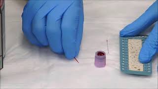 How to Measure the Hematocrit [upl. by Rodablas936]