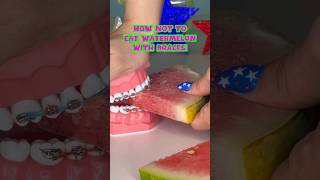 3 ways NOT to eat WATERMELON with BRACES what to eat instead braces watermelon summer [upl. by Catharine]