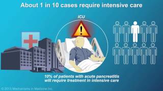 Management and Treatment of Acute Pancreatitis [upl. by Assen]