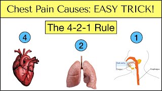 Causes of Chest Pain EASY TRICK to Never Miss an Emergency Must See [upl. by Lindbom]