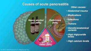 Acute Pancreatitis [upl. by Namijneb]