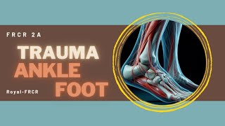 6  MSK amp Trauma Imaging for FRCR [upl. by Groscr]