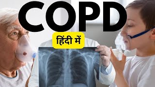 COPD symptoms treatment COPD in Hindi  COPD kya hai  COPD in Hindi [upl. by Parrish]