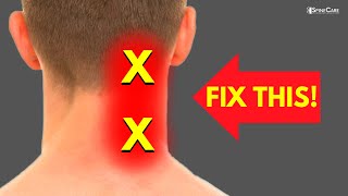 How to Fix Neck Pain off to the Side [upl. by Barthel881]