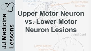 Upper and Lower Motor Neuron Lesions  UMN vs LMN Differences and Mnemonic [upl. by Maxentia]