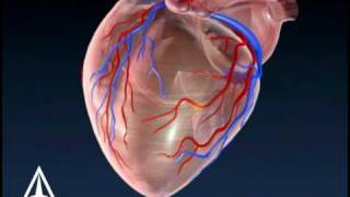 Coronary Plaque  3D Medical Animation [upl. by Blank283]