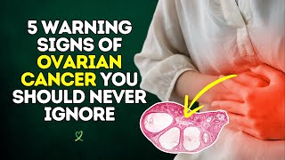 5 Early Warning Signs of Ovarian Cancer You Should Never Ignore [upl. by Amathist]