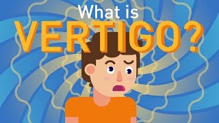 What is Vertigo [upl. by Oicnaneb]