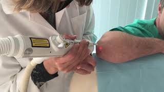 Tratamento da psoriase com laser Lisboa Portugal [upl. by Vittoria]