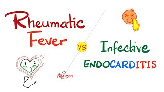 Rheumatic Fever vs Infective Endocarditis  Comparison  Cardiology Series [upl. by Stewart]