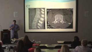 Northwest Indiana Back Specialist Explains CT Scan CAT Scan Spine Surgeon [upl. by Wenz]