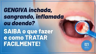 GENGIVA inchada sangrando inflamada ou doendo SAIBA o que FAZER e como TRATAR FACILMENTE [upl. by Wil]