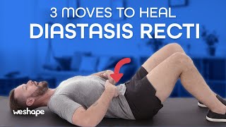 3 Moves To Heal Diastasis Recti [upl. by Welsh]