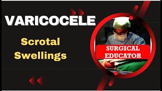 VARICOCELE How To DIAGNOSE amp TREAT Scrotal Swellings [upl. by Rother]