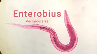 Enterobius vermicularis OXIURO [upl. by Rasaec878]