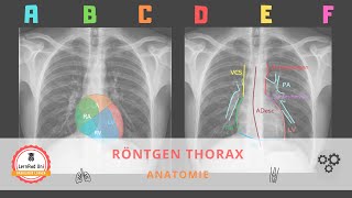 Anatomie im Röntgen Thorax [upl. by Ellened]