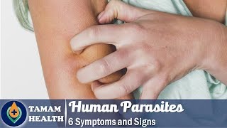 6 Symptoms of Human Parasites Everyone Should Know [upl. by Nyladnohr]