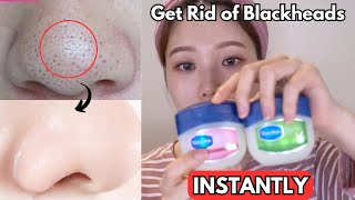 How I INSTANTLY Removed My Blackheads with VASELINE [upl. by Etnwahs]