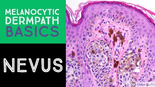 Melanocytic Dermpath Basics Benign Nevus [upl. by Querida989]