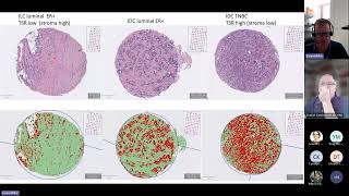 Statewide Biobank Seminar Series  AProf Ewan Millar AI in Anatomical Pathology [upl. by Yauq]